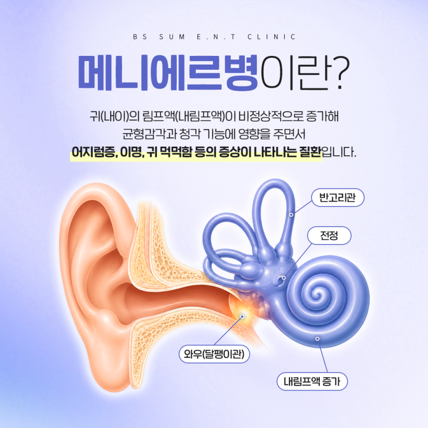 7b0141d1361468b0fe681f3fc95caef4_1788326381_8917.png
